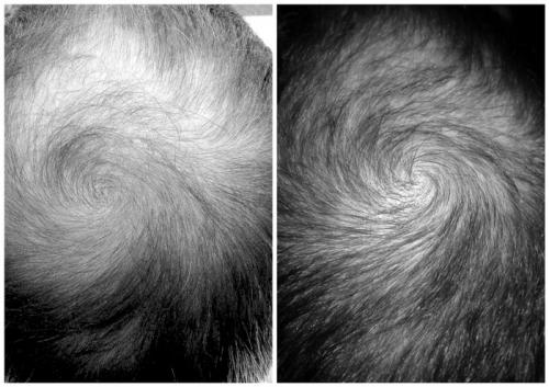 Before_After_ Hair Booster